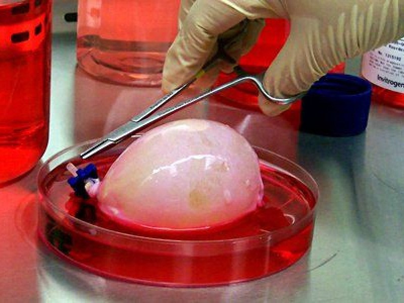 Billionaire-backed startup wants to grow headless human 'organ sacks' to replace animal testing